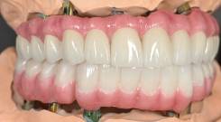 美国假牙代加工OEM定制 - 专注FDA认证义齿出口