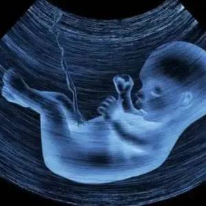 What is China's law on abortion?