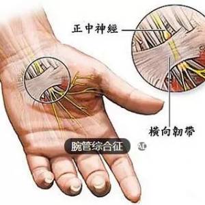 手麻的原因是什么，如何改善？